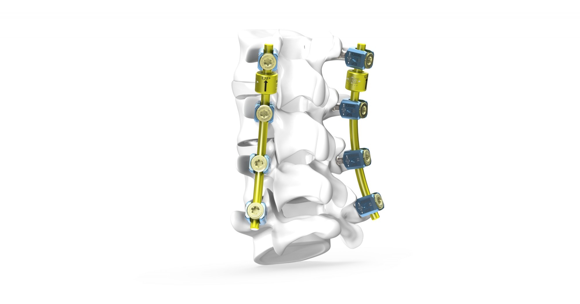 Cousin Biotech B Dyn Posterior Dynamic Stabilization System Spine